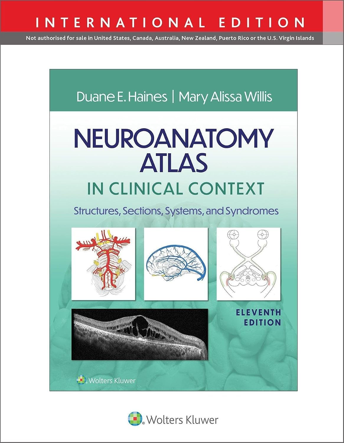 Neuroanatomy Atlas in Clinical Context: Structures, Sections, Systems, and Syndromes, 11th Edition, IE