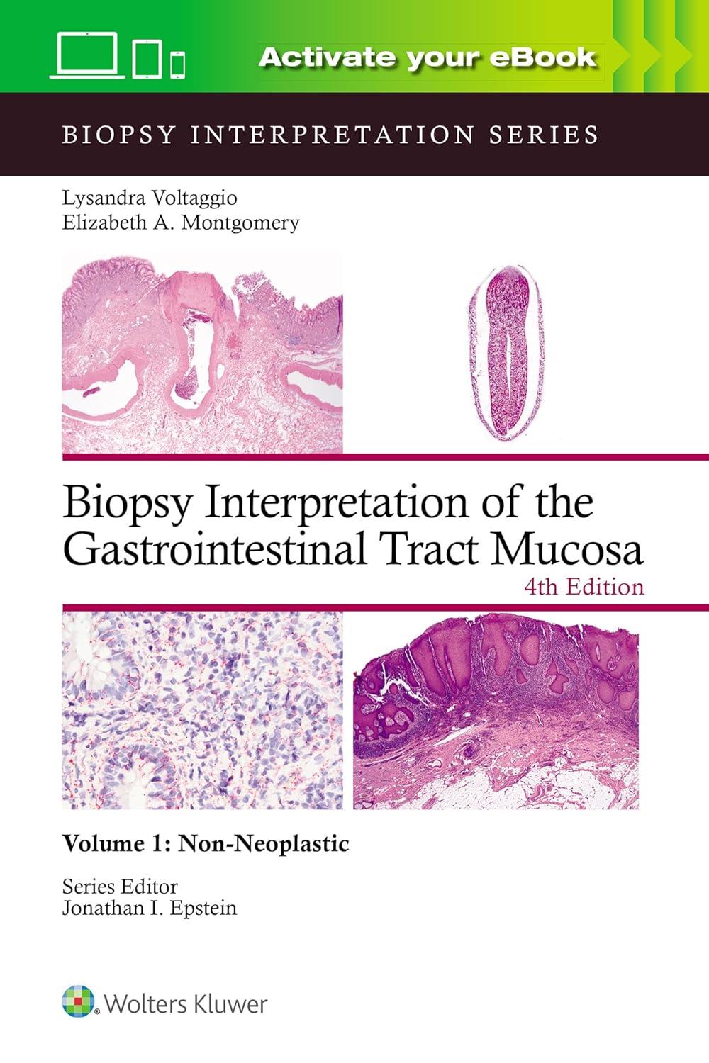Biopsy Interpretation of the Gastrointestinal Tract Mucosa Volume 1: Non-Neoplastic, 4th Edition