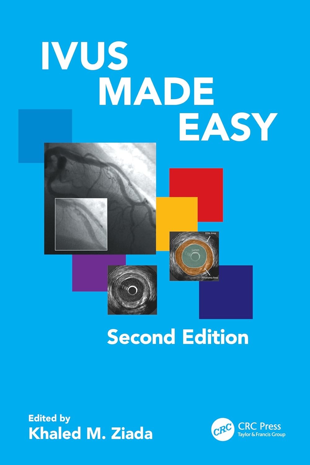 IVUS Made Easy, 2nd Edition
