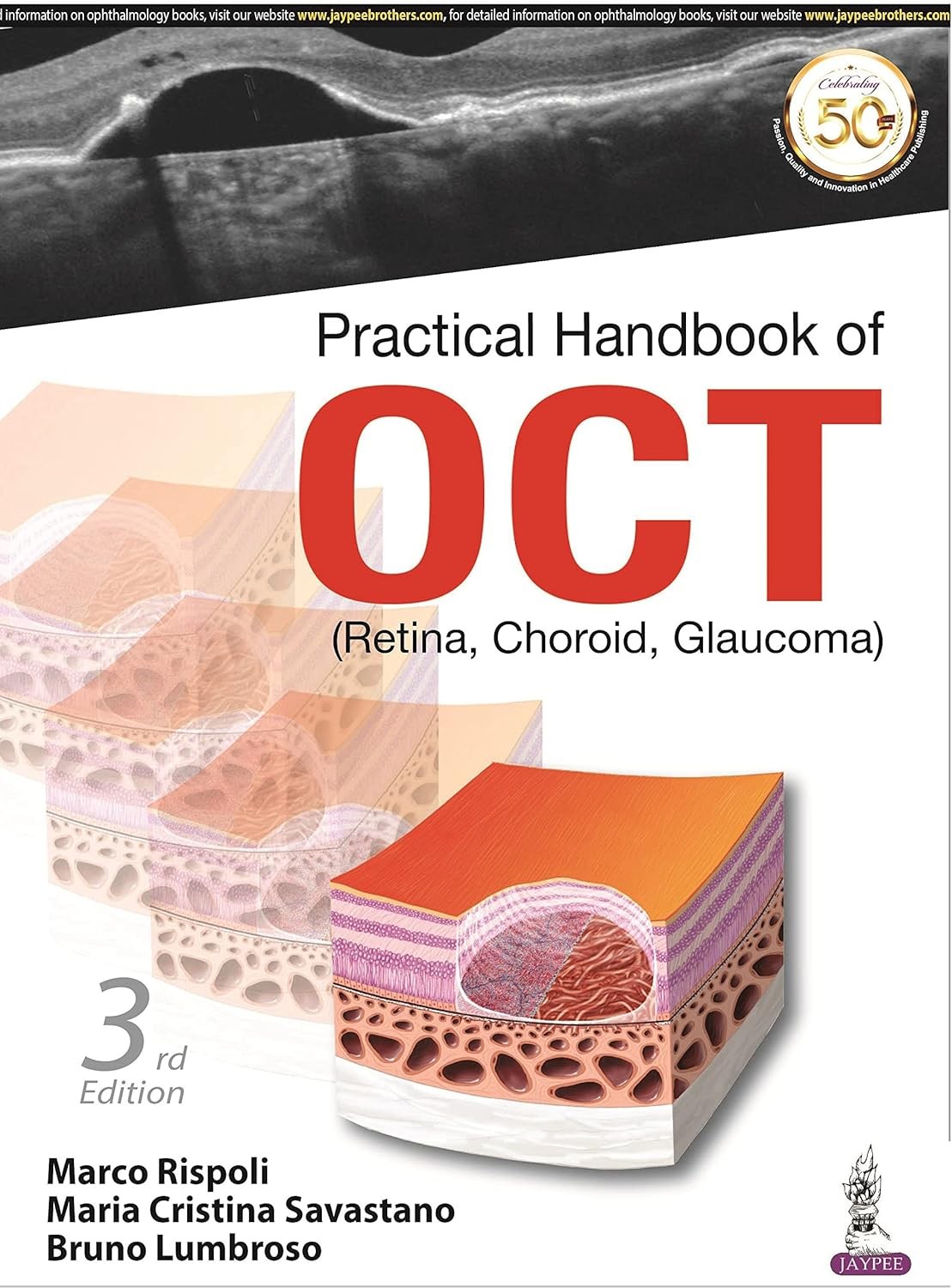 Practical Handbook of OCT: Retina, Choroid, Glaucoma