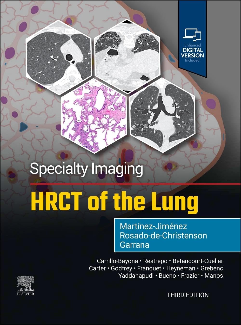 Specialty Imaging: HRCT of the Lung, 3rd Edition