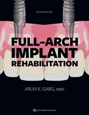 Full-Arch Implant Rehabilitation, 2nd Edition