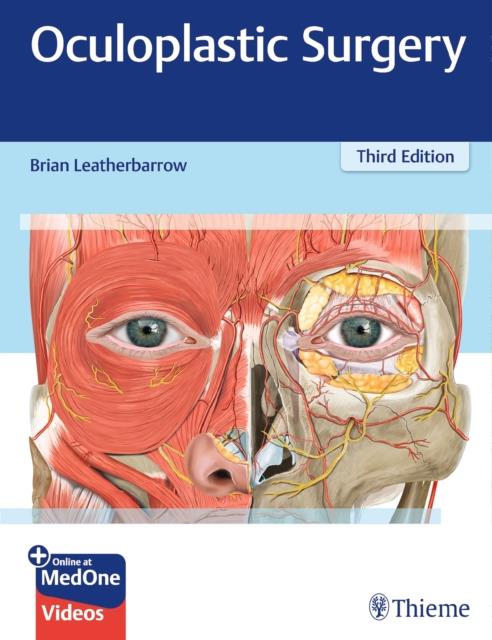 Oculoplastic Surgery 3rd Edition