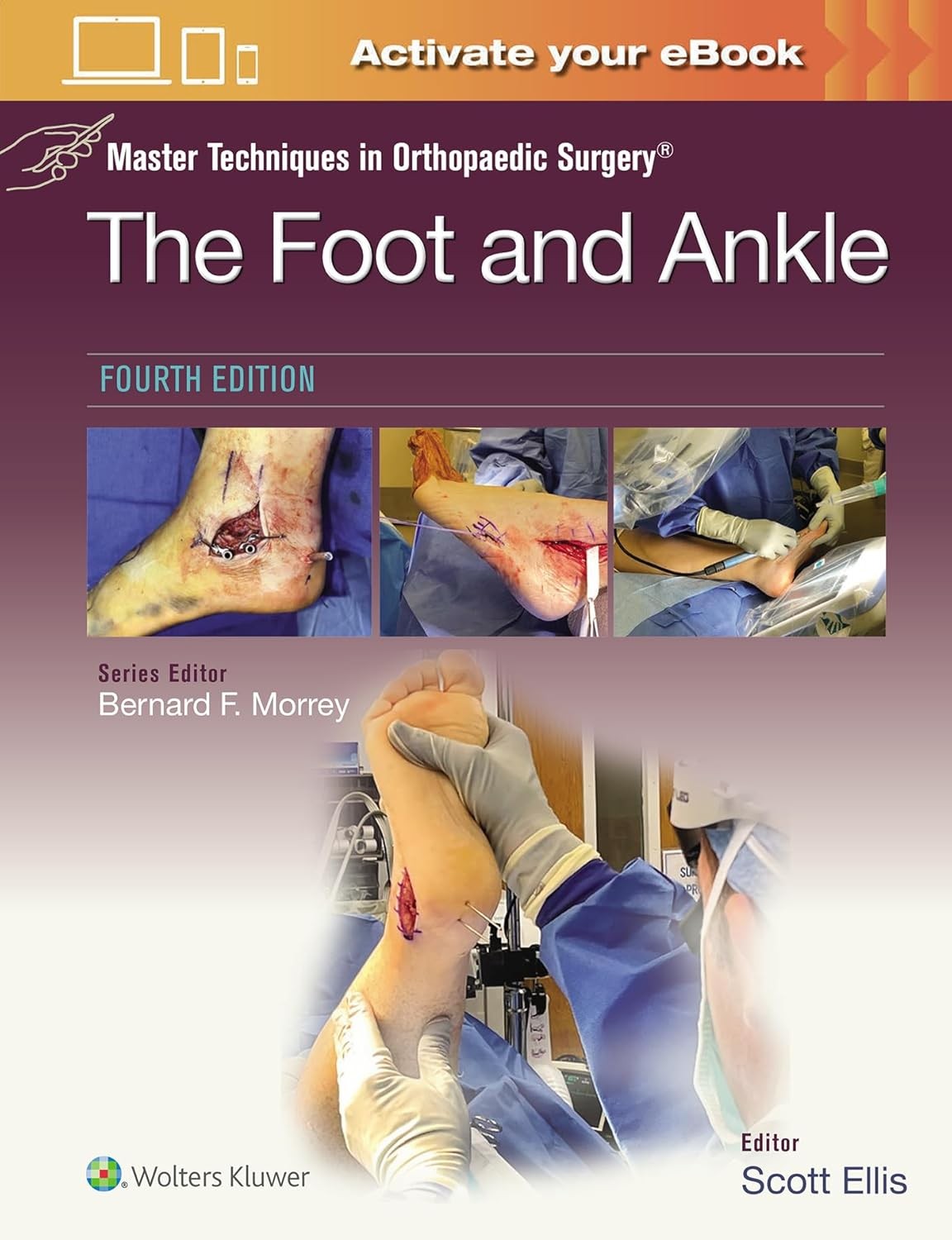 Master Techniques in Orthopaedic Surgery: The Foot and Ankle, 4th Edition