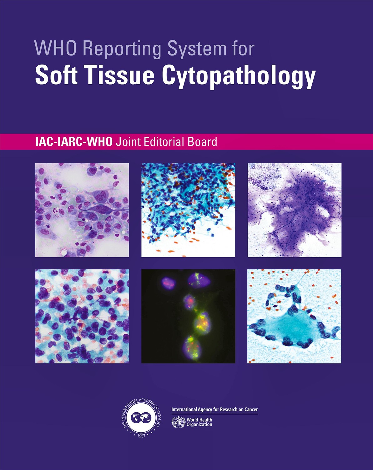 Who Reporting System for Soft Tissue Cytopathology