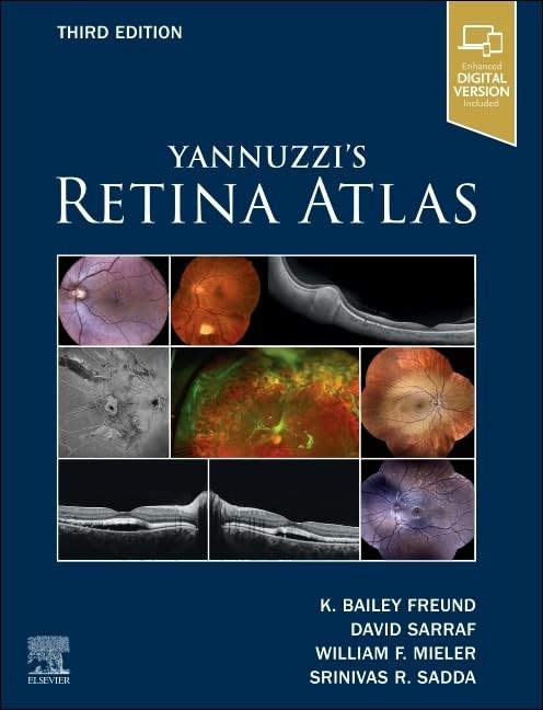 Yannuzzi`s Retina Atlas, 3rd Edition