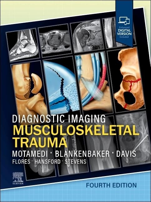 Diagnostic Imaging: Musculoskeletal Trauma, 4th Edition