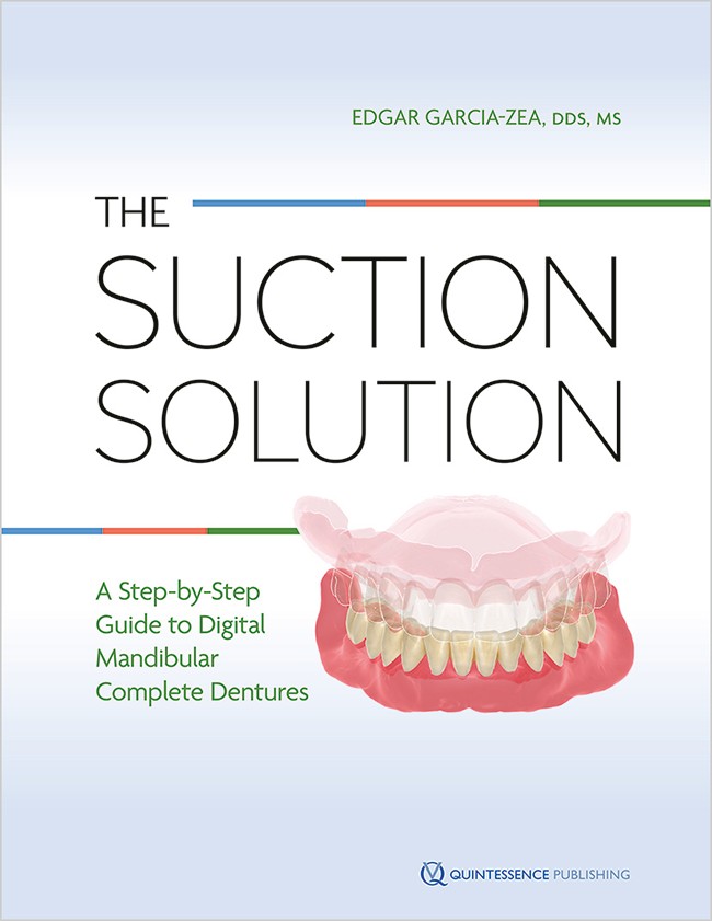 The Suction Solution: A Step-by-Step Guide to Digital Mandibular Complete Dentures