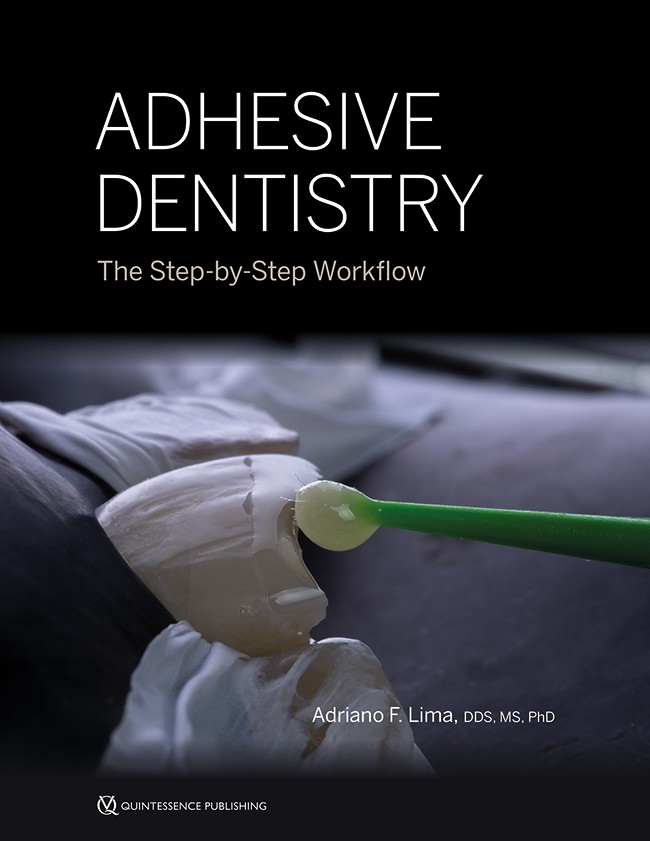 Adhesive Dentistry: The Step-by-Step Workflow