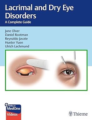 Lacrimal and Dry Eye Disorders: A Complete Guide