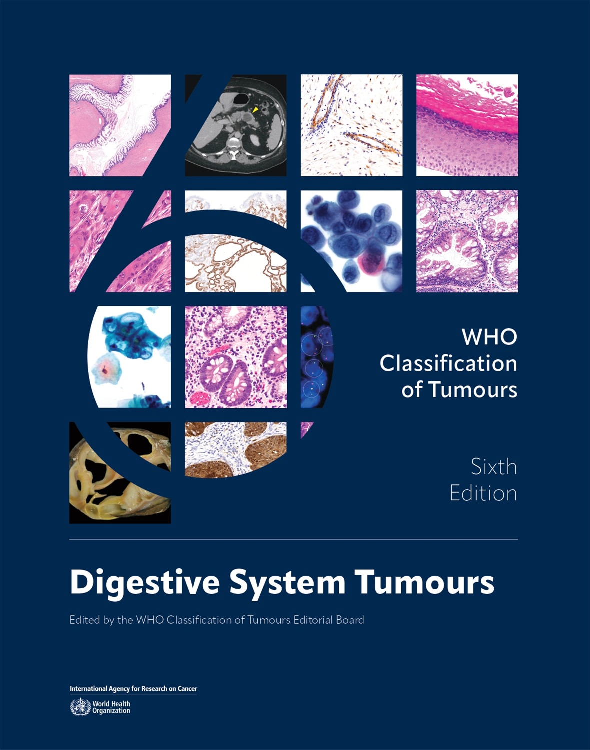 WHO Classification of Digestive Tumours, 6th Edition