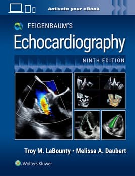 Feigenbaum`s Echocardiography: Print + eBook with Multimedia 9th edition