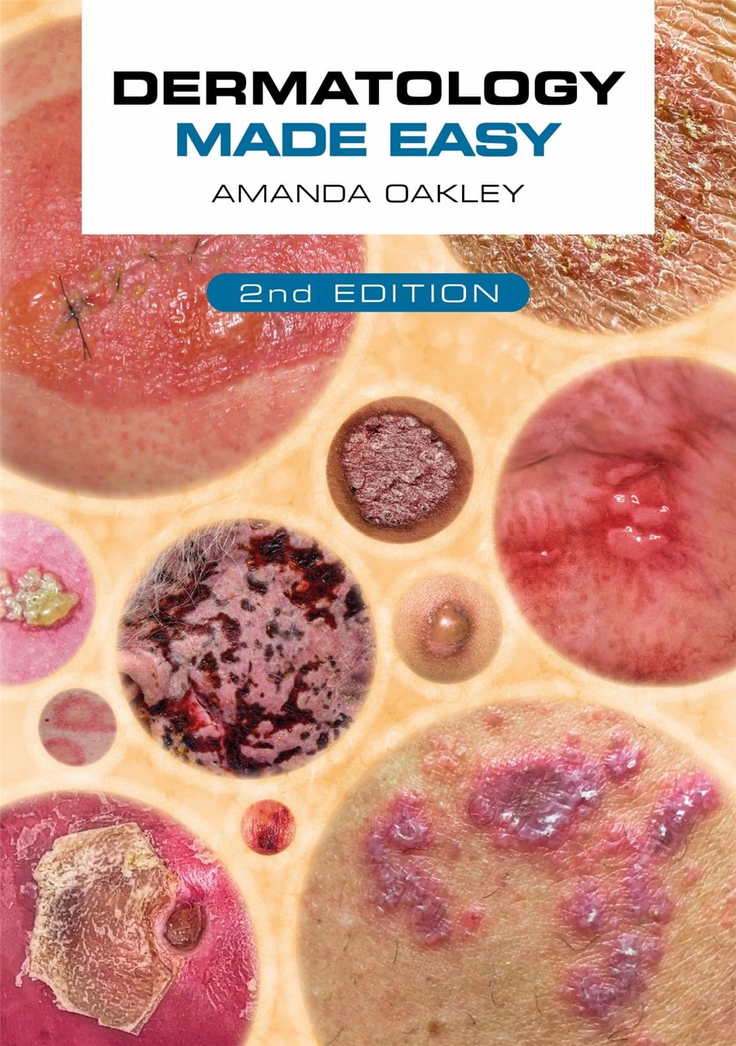 Dermatology Made Easy, 2nd Edition