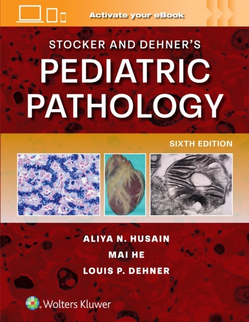 Stocker and Dehner`s Pediatric Pathology, 6th Edition
