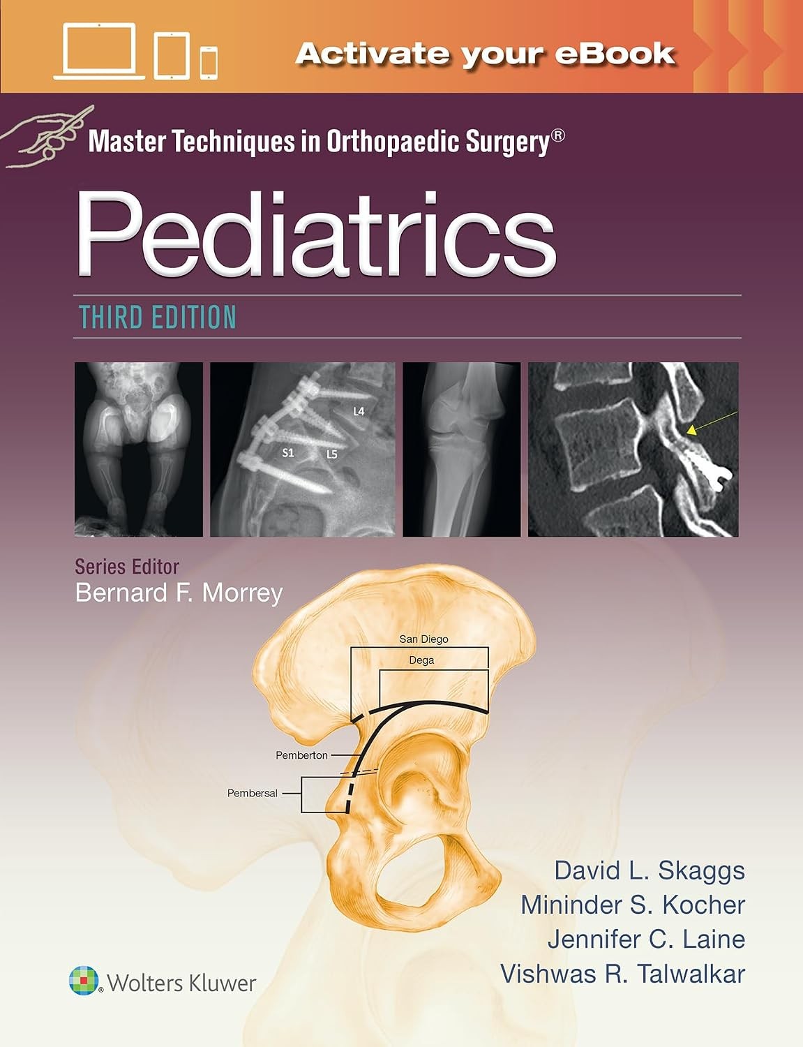 Master Techniques in Orthopaedic Surgery: Pediatrics, 3rd Edition