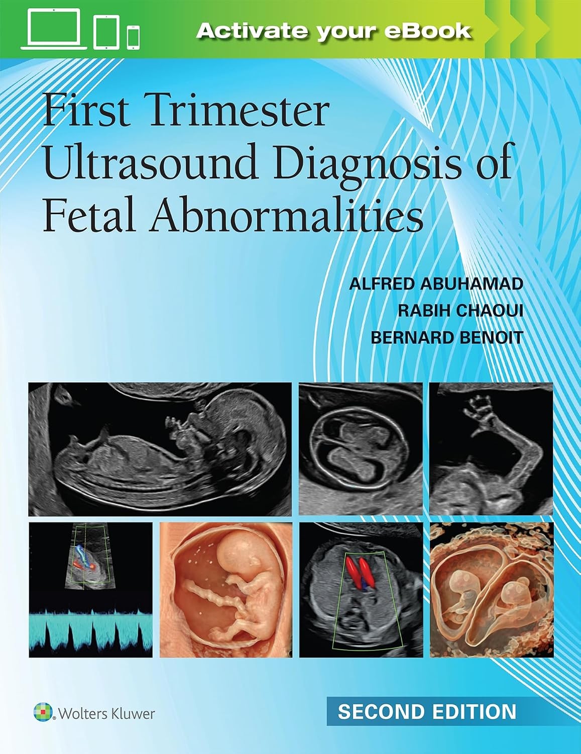 First Trimester Ultrasound Diagnosis of Fetal Abnormalities, 2nd Edition