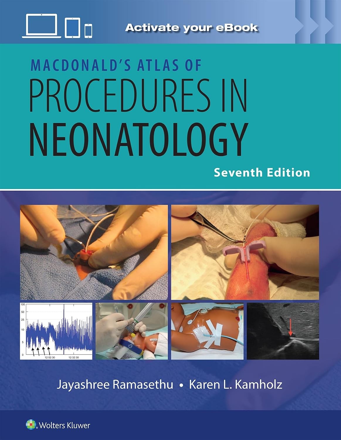 MacDonald’s Atlas of Procedures in Neonatology, 7th Edition