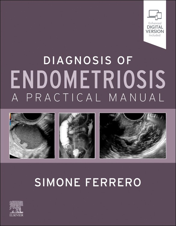 Diagnosis of Endometriosis: A Practical Manual