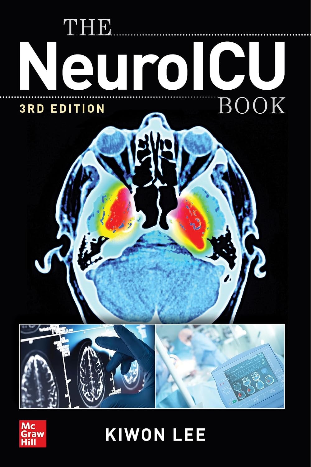 The NeuroICU Book, 3rd Edition