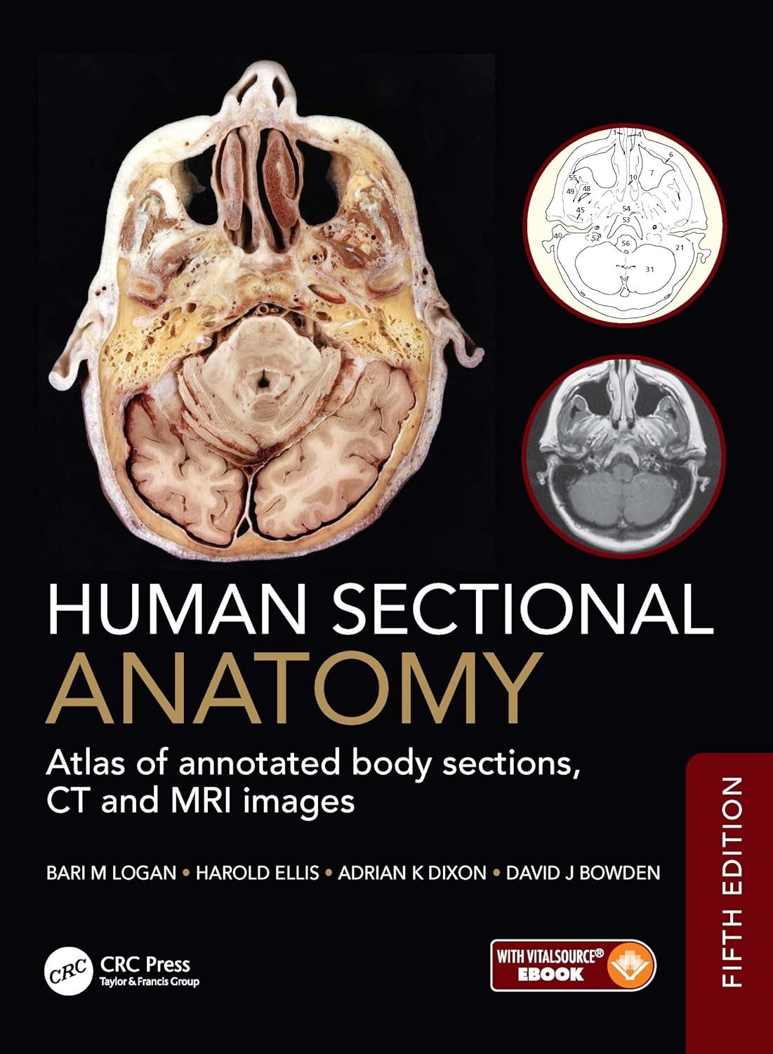 Human Sectional Anatomy: Atlas of annotated body sections, CT and MRI images, 5th Edition