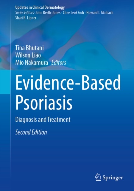 Evidence-Based Psoriasis Diagnosis and Treatment 2nd Edition