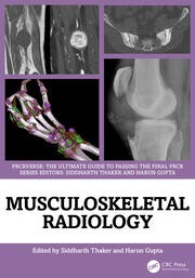 Musculoskeletal Radiology: An Ultimate Guide to Passing the Final FRCR