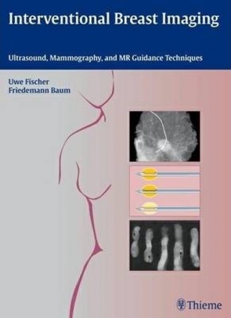 Interventional Breast Imaging: Ultrasound, Mammography, and MR Guidance Techniques