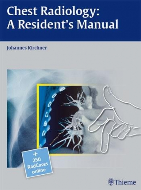Chest Radiology: A Resident`s Manual