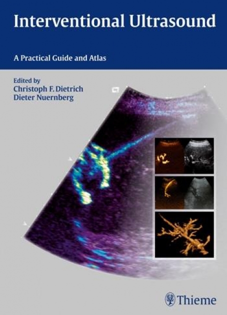 Interventional Ultrasound: Practical Guide and Atlas