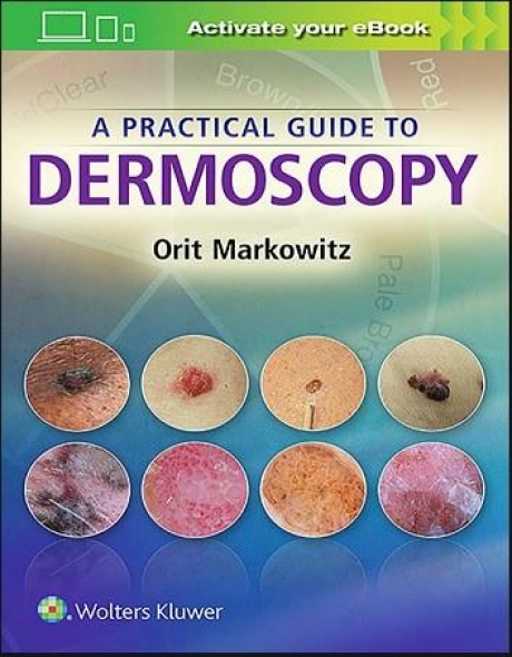 A Practical Guide to Dermoscopy