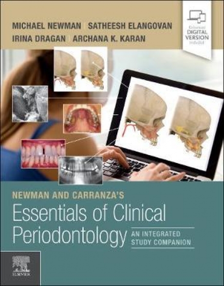 Newman and Carranza`s Essentials of Clinical Periodontology An Integrated Study Companion