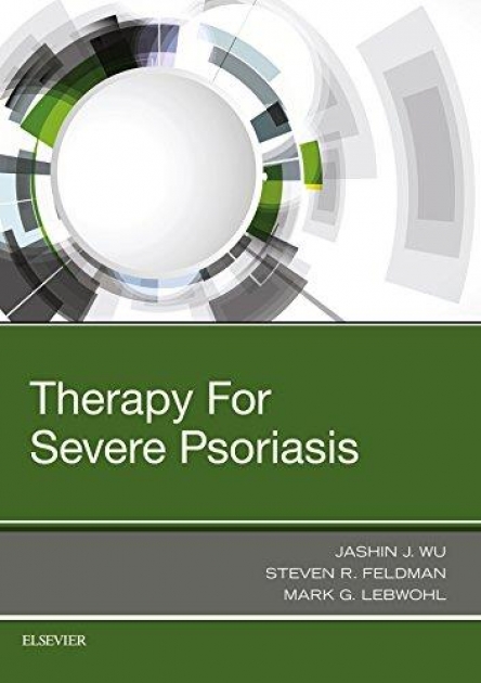 Therapy for Severe Psoriasis, 1st Edition