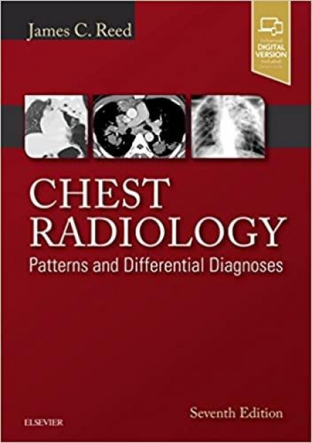 Chest Radiology, 7th Edition