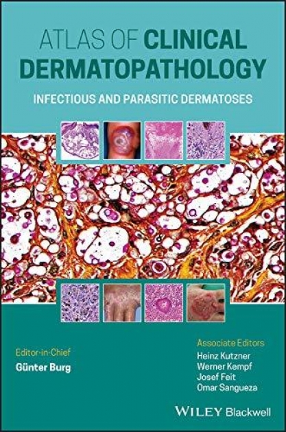 Atlas of Clinical Dermatopathology: Infectious and Parasitic Dermatoses