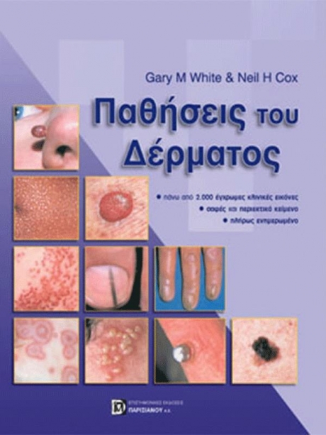Παθήσεις του Δέρματος