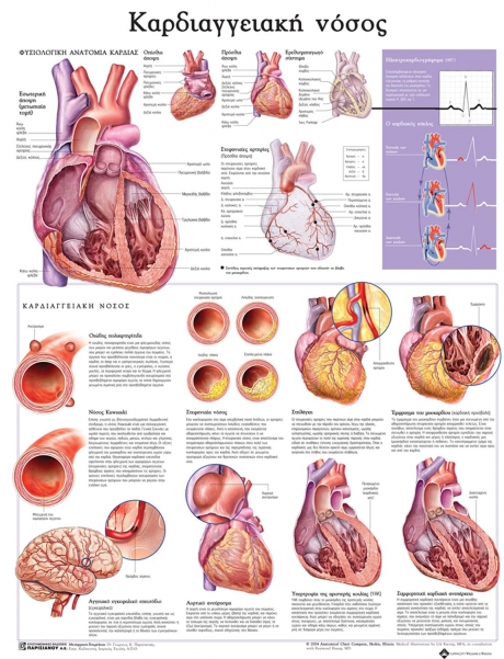 Ανατομικός Χάρτης: Καρδιαγγειακή Νόσος