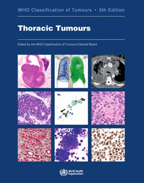 WHO Classification of Tumours Thoracic Tumours, 5th Edition