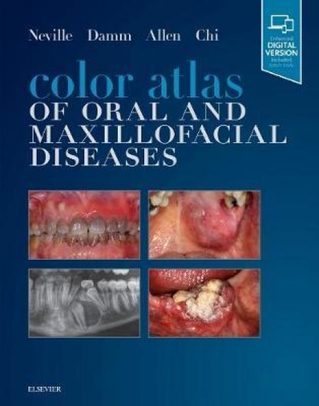 Color Atlas of Oral and Maxillofacial Diseases, 1st Edition