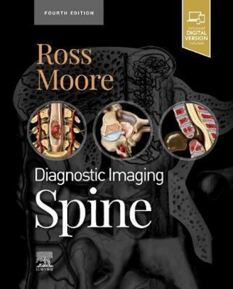 Diagnostic Imaging: Spine, 4th Edition
