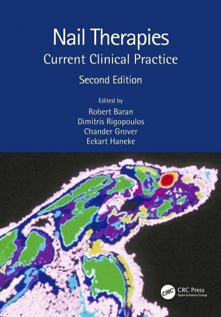Nail Therapies: Current Clinical Practice 2nd Edition