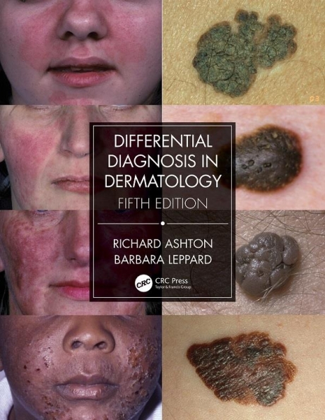 Differential Diagnosis in Dermatology 5th Edition