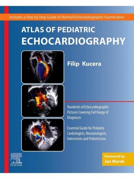 Atlas of Pediatric Echocardiography
