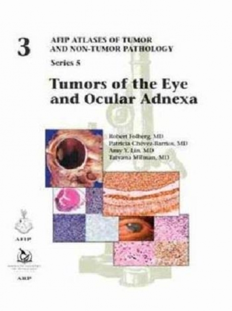 Tumors of the Eye and Ocular Adnexa (AFIP Atlases of Tumor and Non-Tumor Pathology, Series 5)