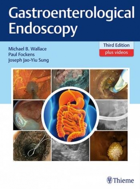Gastroenterological Endoscopy 3e