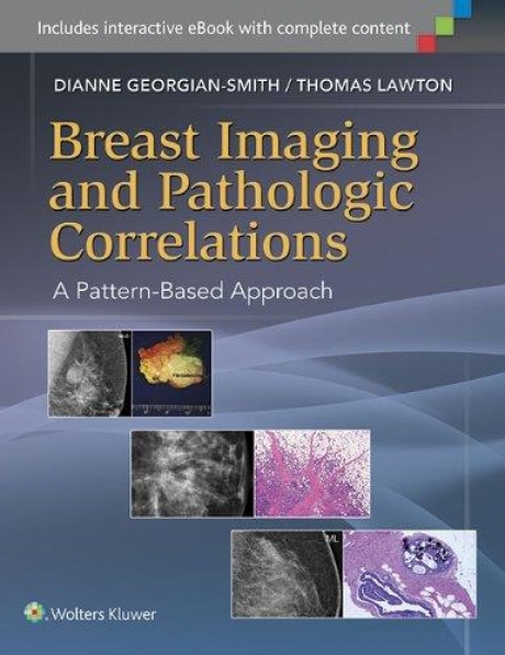 Breast Imaging and Pathologic CorrelationsA Pattern-Based Approach, First edition