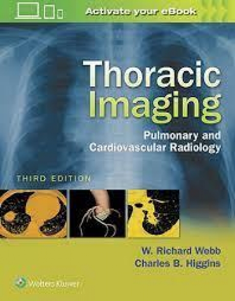 Thoracic Imaging Pulmonary and Cardiovascular Radiology, 3rd Edition