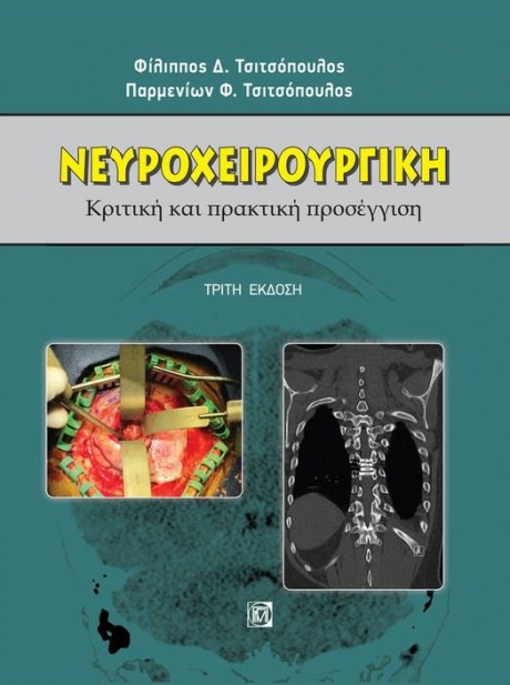 Νευροχειρουργική Κριτική και πρακτική προσέγγιση 3η Έκδοση
