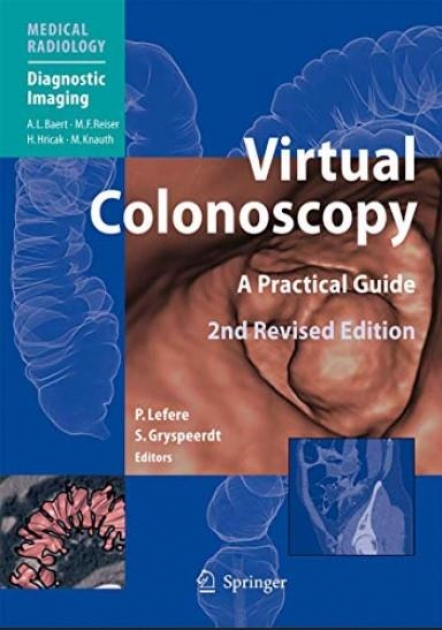 Virtual Colonoscopy: A Practical Guide, 2nd Edition