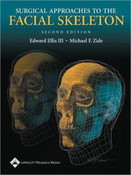 Surgical Approaches to the Facial Skeleton, 2nd Edition