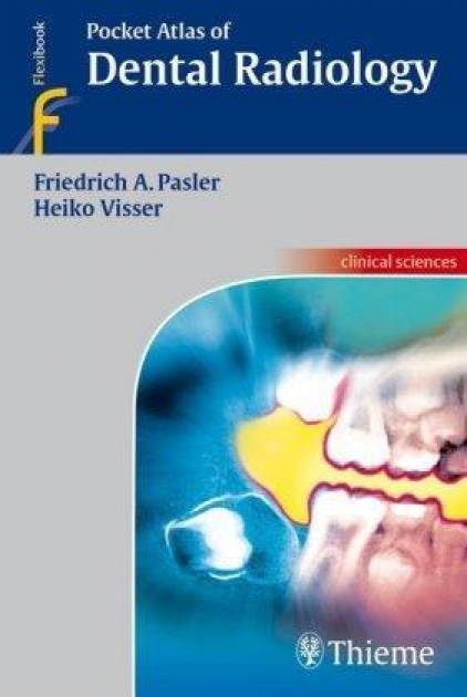 Pocket Atlas of Dental Radiology, 1st Edition